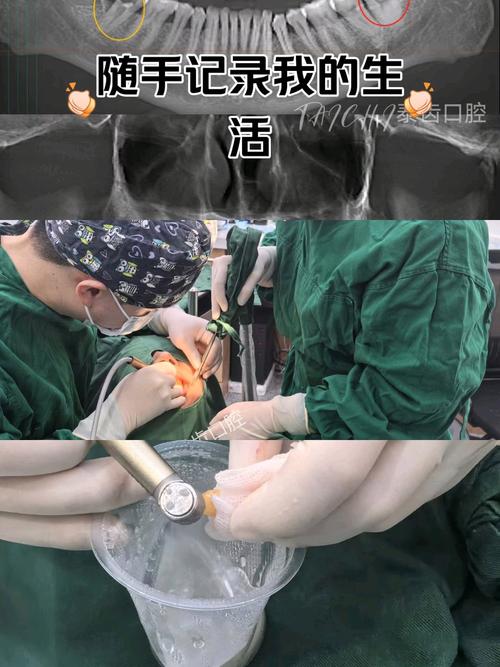 种牙填充能抬高牙床吗?具体操作步骤有哪些?-图1 种牙填充能抬高牙床吗?具体操作步骤有哪些?-图1