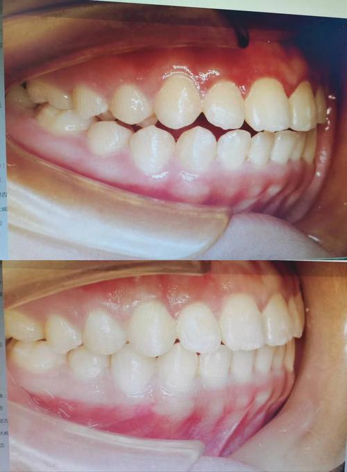 哪些相机适合口腔正畸拍照?专业高性价比好用热门推荐款怎么选?-图3 哪些相机适合口腔正畸拍照?专业高性价比好用热门推荐款怎么选?-图3