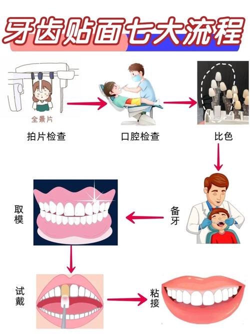 前牙贴面的预备方法-图1 前牙贴面的预备方法-图1
