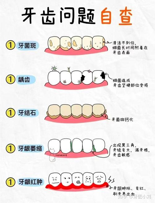 清洗牙齿有哪些实用又安全的方法？-图2