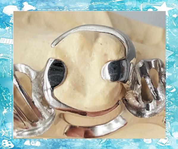 牙科卡环焊接方法有哪些关键操作要点？-图3