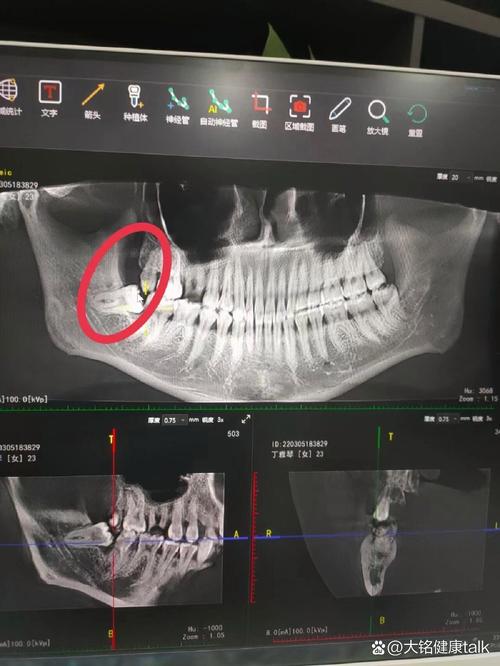 乌鲁木齐最好的种牙去哪找？如何判断哪家医院更值得选？-图2