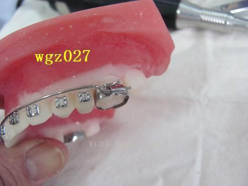 正畸技工简答题常考哪些核心内容？-图3