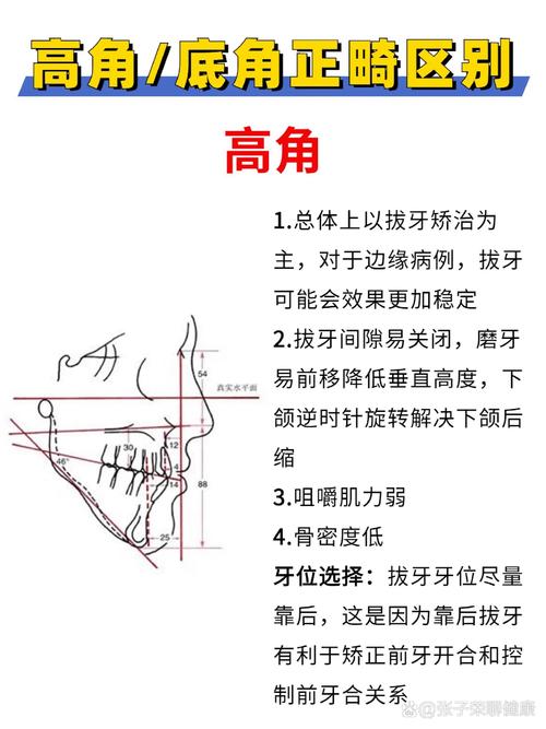 正畸研究生高角病例PPT研究重点与难点是什么？-图3