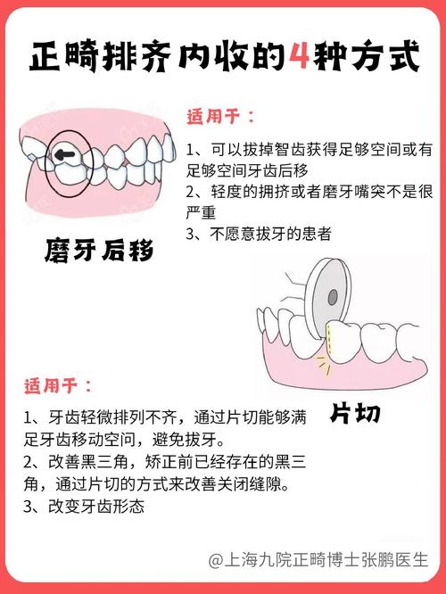 口腔内提升常用方法有哪些?如何根据情况选择合适的方法?-图3 口腔内提升常用方法有哪些?如何根据情况选择合适的方法?-图3
