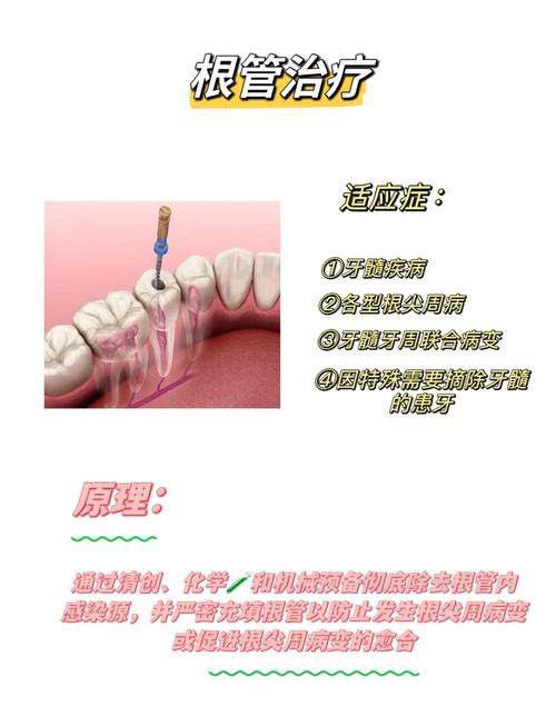 残髓用什么方法处理-图1