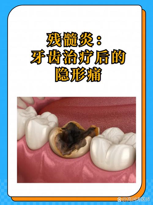 残髓用什么方法处理-图2