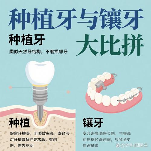 种牙镶牙纠结选？哪种更适合你？-图2