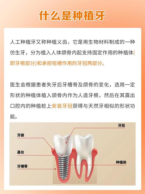 牙槽骨厚度多少毫米适合种牙?-图3 牙槽骨厚度多少毫米适合种牙?-图3