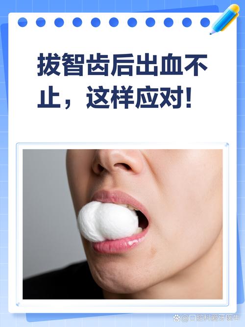 拔牙后出血不止？正确止血方法是什么？-图1