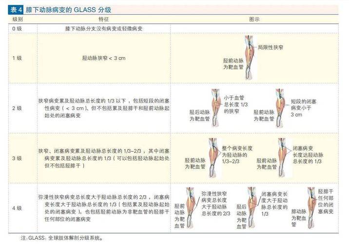 临床不同类型疾病常用的血运重建方法各有何具体适应证与选择策略?-图1 临床不同类型疾病常用的血运重建方法各有何具体适应证与选择策略?-图1