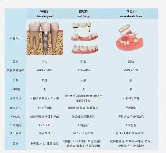 做牙桥好还是种牙好-图2