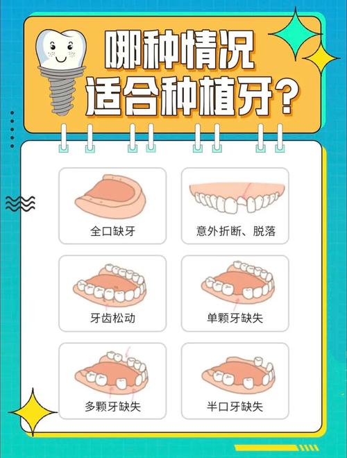 口腔种植有哪些种类?不同种植方法各有何区别与选择要点?-图3 口腔种植有哪些种类?不同种植方法各有何区别与选择要点?-图3