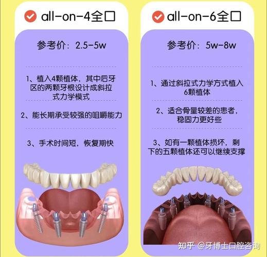 口腔种植有哪些种类?不同种植方法各有何区别与选择要点?-图1 口腔种植有哪些种类?不同种植方法各有何区别与选择要点?-图1
