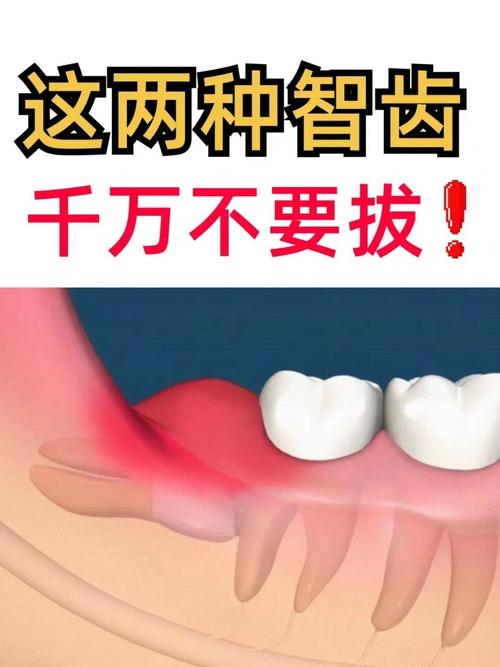 拔完智慧牙后，种牙是必须的治疗方案吗？-图1