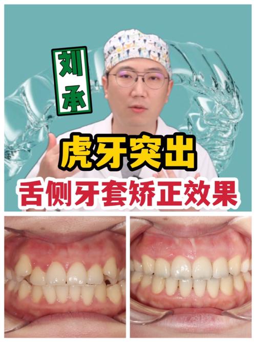 如何才能科学有效地长出虎牙?有哪些方法或技巧可以尝试呢?-图2 如何才能科学有效地长出虎牙?有哪些方法或技巧可以尝试呢?-图2