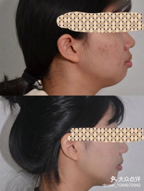 北京瑞泰口腔医院正畸怎么样？选择要注意啥？-图2