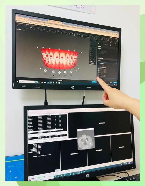北京瑞泰口腔医院正畸怎么样？选择要注意啥？-图1