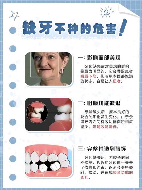 缺牙没钱种牙怎么办？-图1