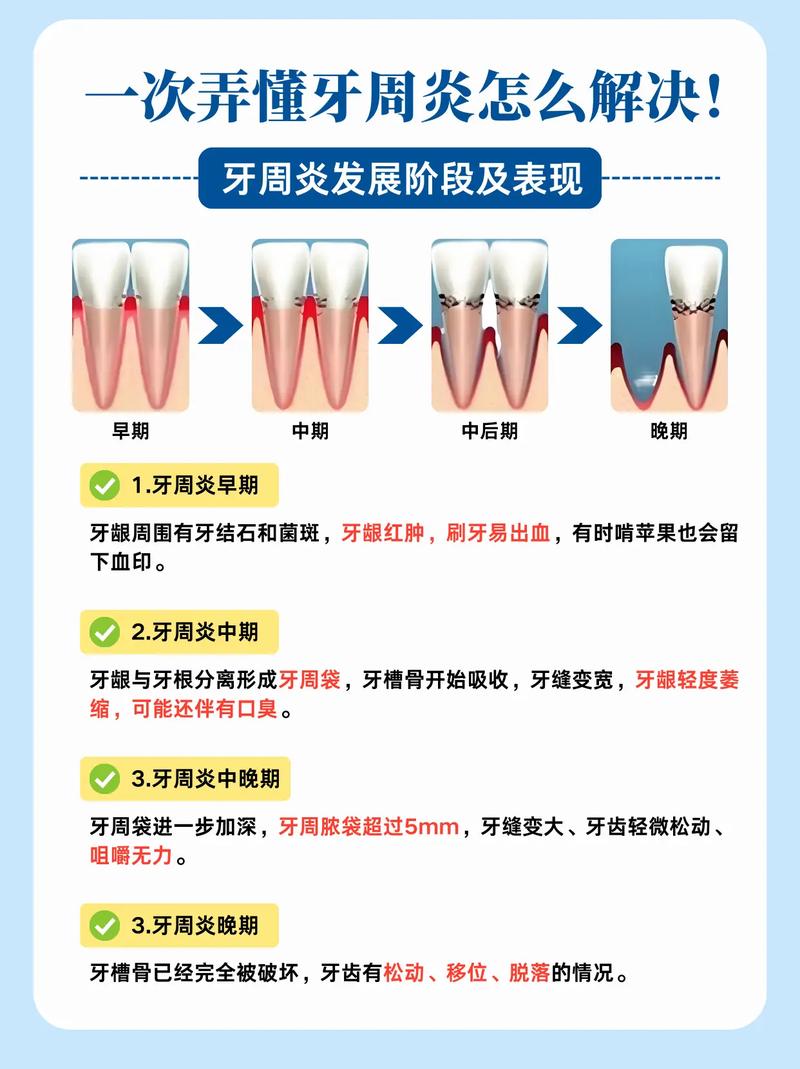 牙周炎种牙是否必须全部种植?-图1 牙周炎种牙是否必须全部种植?-图1