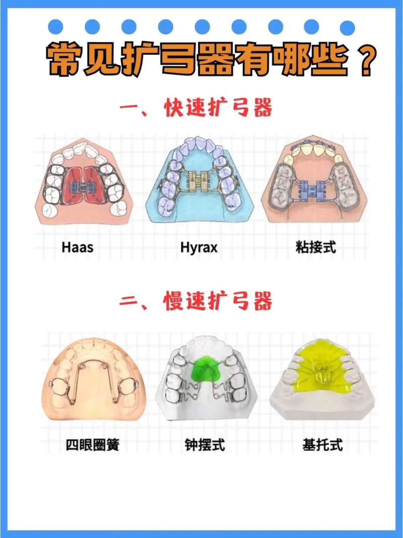 正畸矫正过程中前牙怎样实现有效内收？-图2