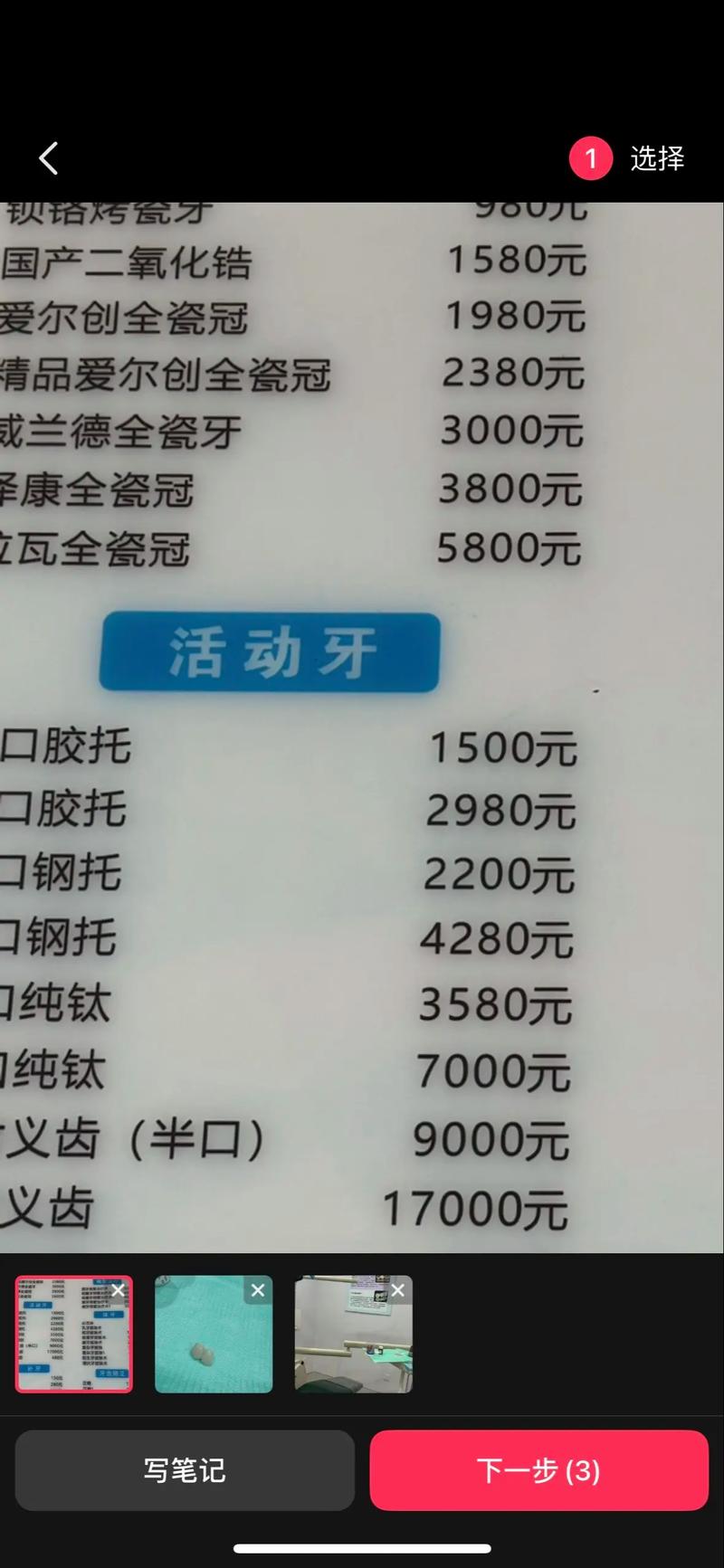 济南正畸价格怎么查?來搜圣贝有门道?-图3 济南正畸价格怎么查?來搜圣贝有门道?-图3