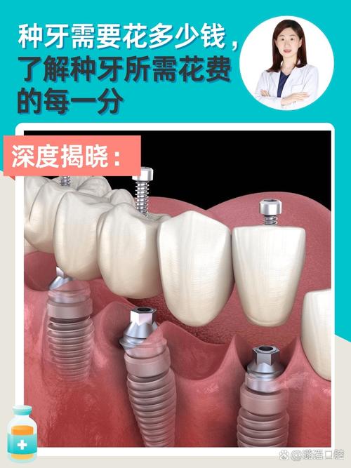 牙博会后期种牙补贴是否还能享受？申请流程和条件有哪些？-图2