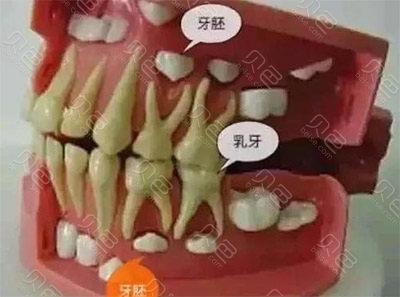 继续教育儿童正畸的答案有哪些关键点？-图2