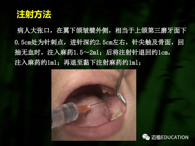 口腔下部局麻常用方法有哪些？操作步骤与注意事项是什么？-图2