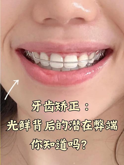 临牙倾斜种牙为何要先矫正？-图3