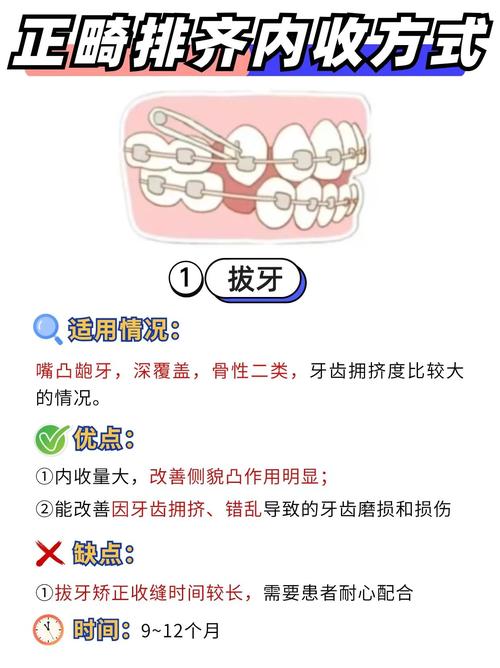 矫正牙齿有几种方法？如何选择合适的方式？-图3