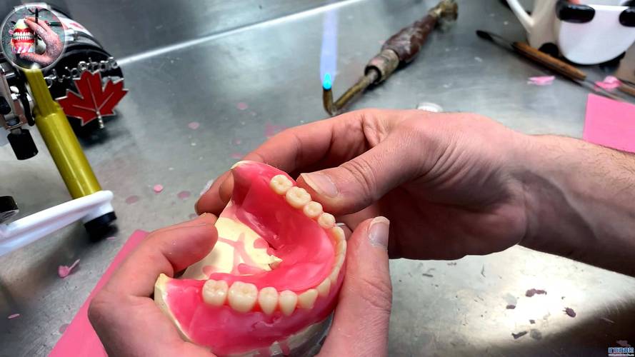 青岛假牙制作方法的具体步骤是怎样的？-图3