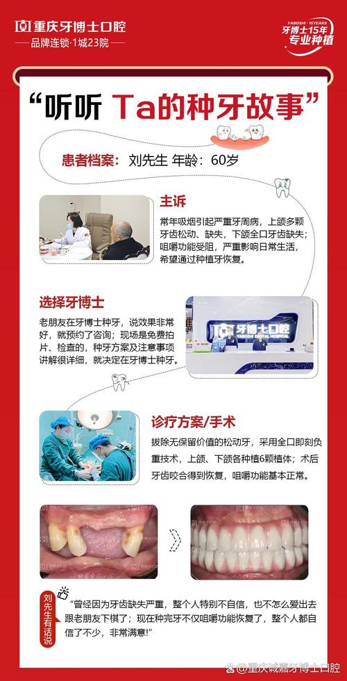 牙博士种牙感受究竟如何？过程体验与效果的真实分享值得参考吗？-图1