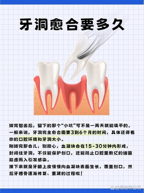 如何促进拔牙创口快速愈合？-图2