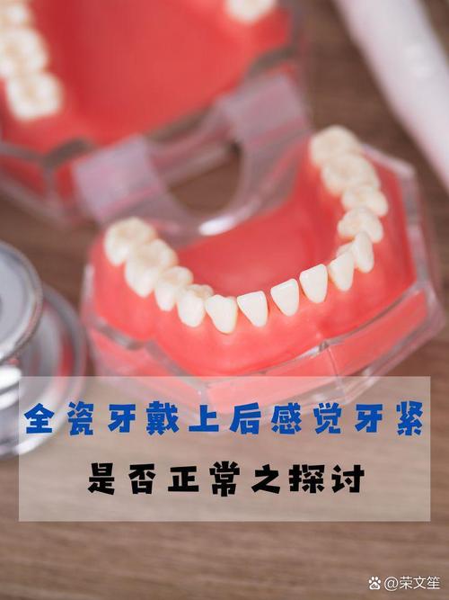 全瓷牙修复中如何正确密封？关键步骤方法与注意事项详解-图2