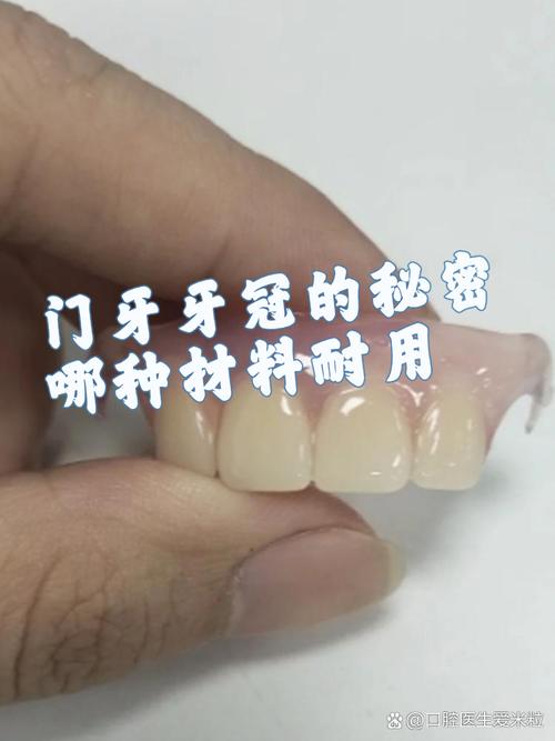 全瓷牙修复中如何正确密封？关键步骤方法与注意事项详解-图1