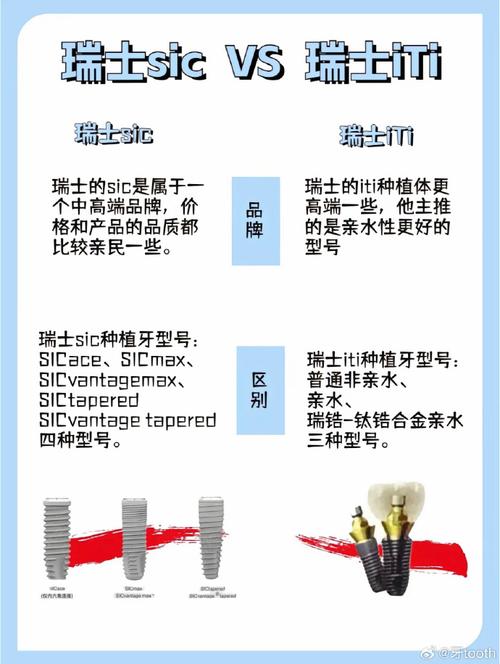 瑞士Noble种牙效果好吗？有哪些技术优势？适合哪些人群呢？-图1