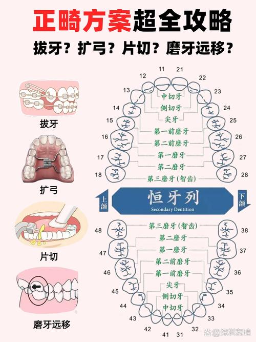 前牙内收有什么方法-图3