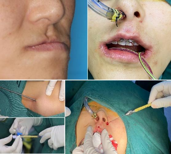 正畸为何倾向国外,正颌倾向国内?选择差异的原因是什么?-图1 正畸为何倾向国外,正颌倾向国内?选择差异的原因是什么?-图1