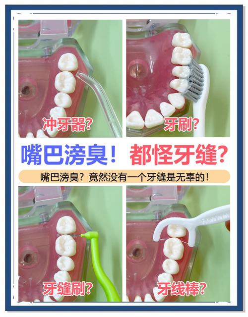 烂牙缝怎么处理？实用方法有哪些？-图2