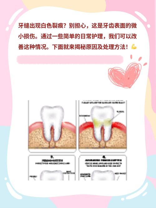 烂牙缝怎么处理？实用方法有哪些？-图1