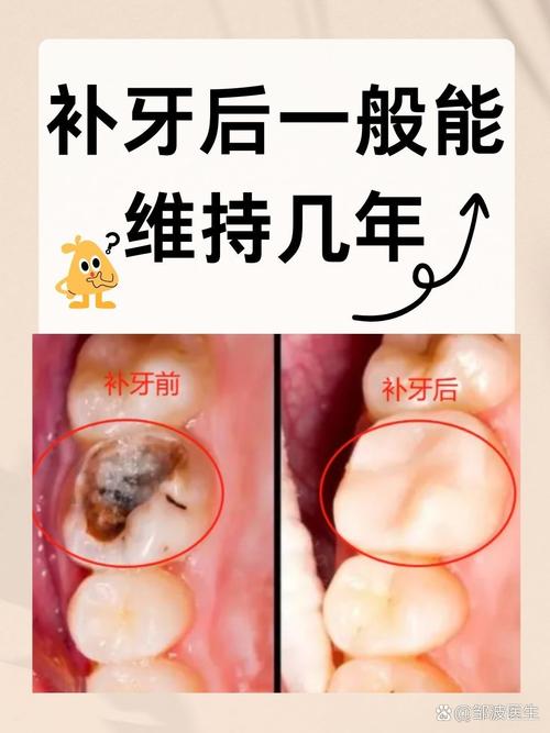 如何有效破坏牙齿菌膜？这些方法真的管用吗？有哪些具体步骤？-图1