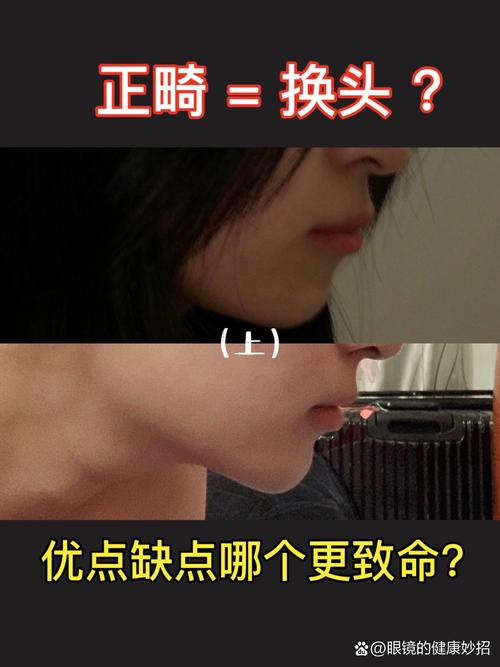 正畸后遗症出现机率究竟有多高？-图2