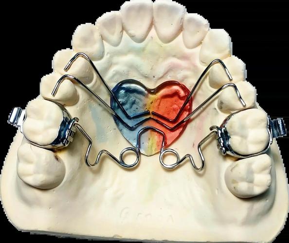 磨牙单个矫正有哪些可行方法？具体操作步骤和注意点是什么？-图1