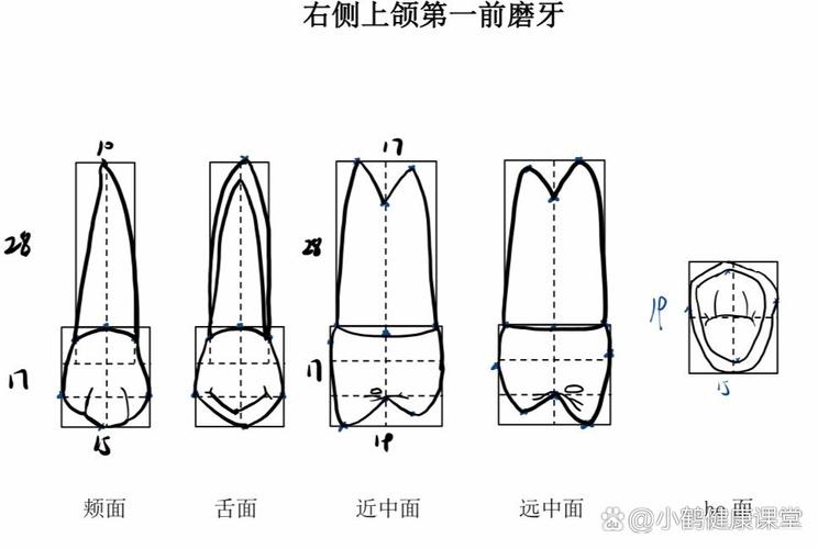 上颌尖牙牙体预备的关键方法及操作步骤有哪些？-图1