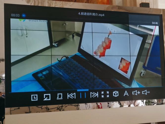 如何用相机拍好正畸照？关键技巧与要点有哪些？-图1