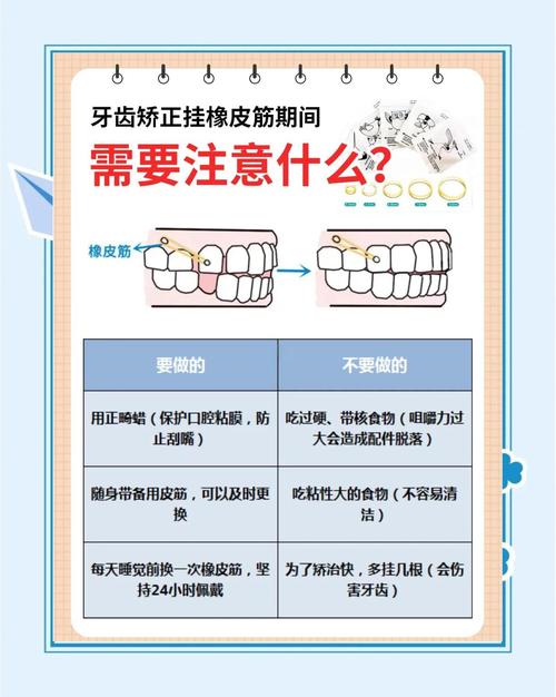 正畸橡皮圈的使用原则具体包含哪些关键内容？-图2