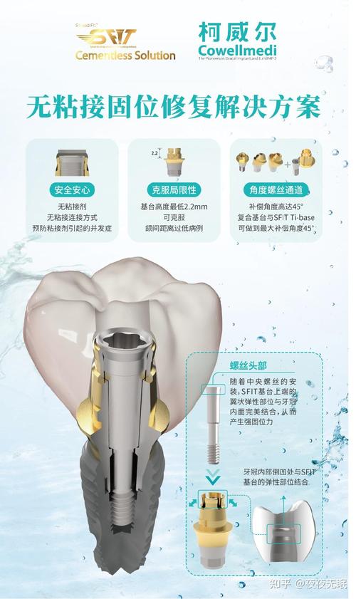 面对市面上琳琅满目的种牙植体品牌，到底该如何根据自身口腔状况挑选？不同品牌的技术优势、使用寿命和价格差异究竟有多大？-图2