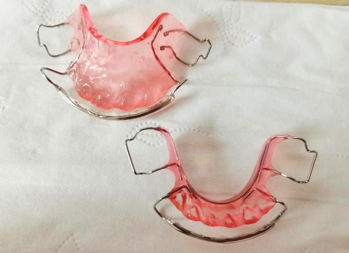 儿童正畸保持器选哪种？不同类型适用情况有何差异？医生建议如何科学选择？-图1