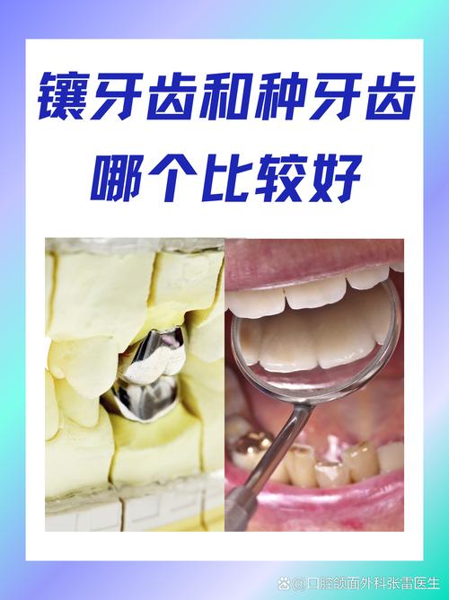 牙齿缺损后，补牙和种牙到底哪个更合适？需综合考虑损伤程度、治疗费用、耐用性及长期维护等多方面因素吗？-图3